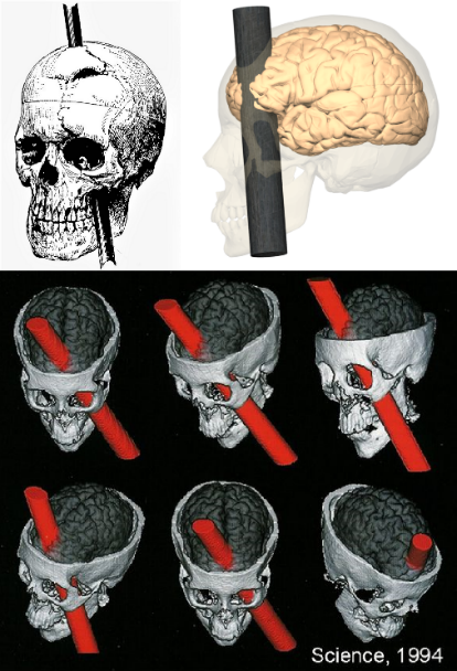 Rappresentazione grafica (d'epoca) e in CGI dell'area del cervello di Phineas Gage interessata dall'incidente